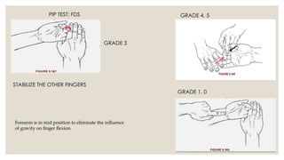 CLINICAL EXAMINATION OF THE HAND & WRIST JOINT. SLIDESHARE.pptx