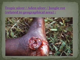 Ulcus Rodems Clinical examination of ulcers | PPTX