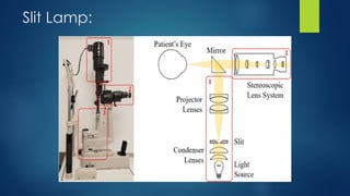 Slit Slide Clinical Examinations in Ophthalmology.pptx
