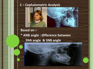 Clinical extraoral examination | PPTX