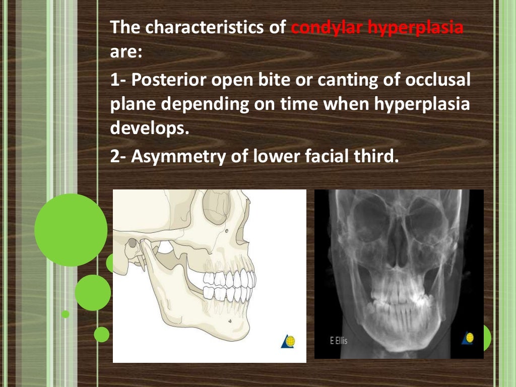Clinical extraoral examination