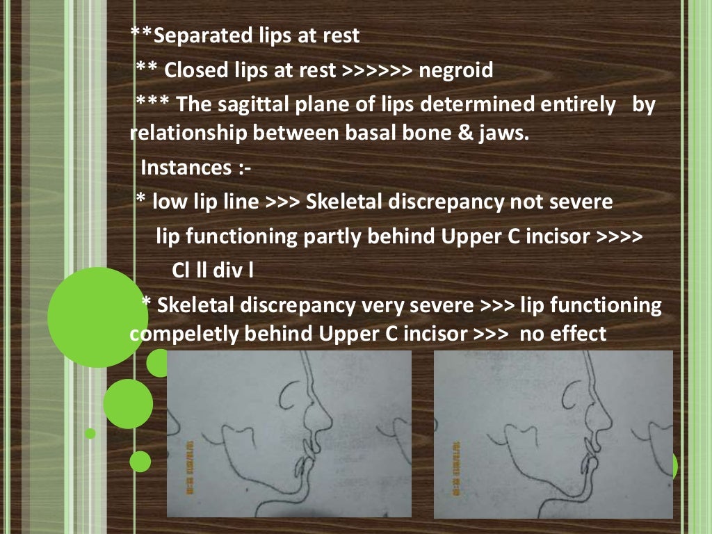 Clinical extraoral examination