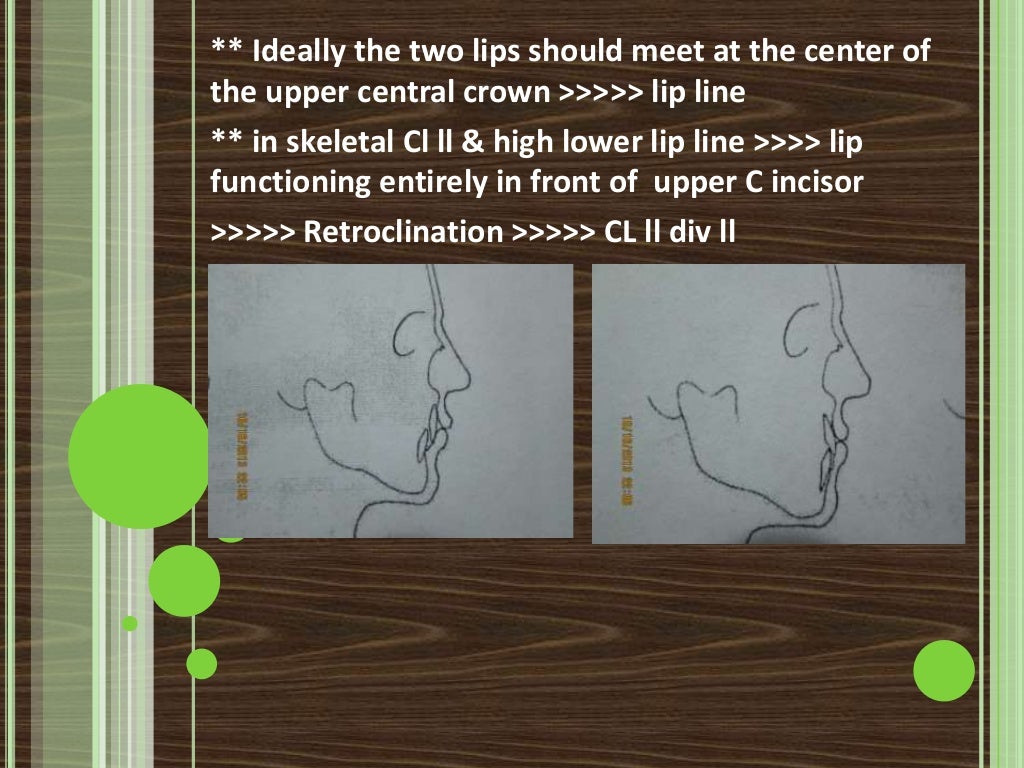 Clinical extraoral examination