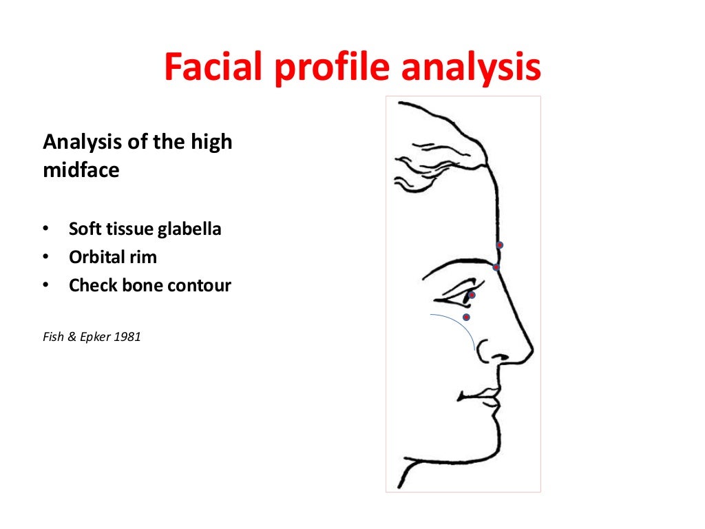 Clinical facial analysis (cfa) for orthodontists