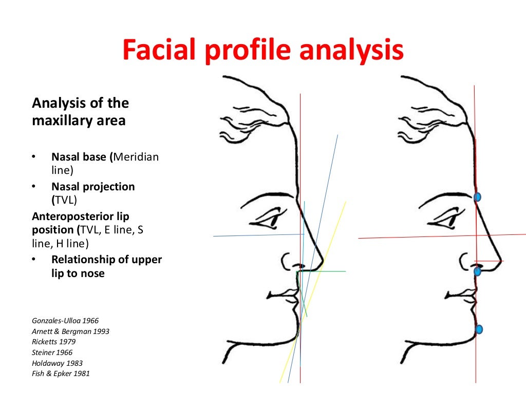 Clinical facial analysis (cfa) for orthodontists