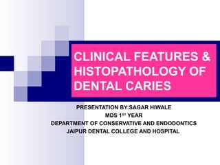 CLINICAL FEATURES &
HISTOPATHOLOGY OF
DENTAL CARIES
PRESENTATION BY:SAGAR HIWALE
MDS 1ST
YEAR
DEPARTMENT OF CONSERVATIVE AND ENDODONTICS
JAIPUR DENTAL COLLEGE AND HOSPITAL
 