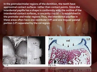 Clinical features and stages of gingivitis | PPTX