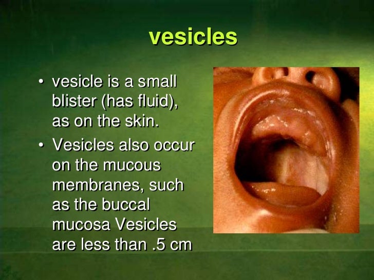 Clinical features of allergic stomatitis