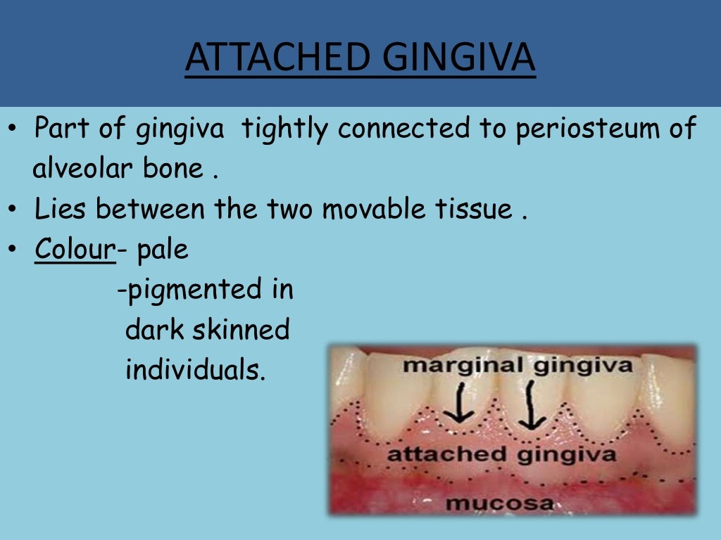 Clinical features of gingiva