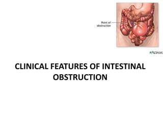 CLINICAL FEATURES OF INTESTINAL
          OBSTRUCTION
 