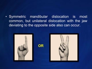 Symmetric mandibular dislocation is most common, but unilateral dislocation with the jaw deviating to the opposite side also can occur.OR