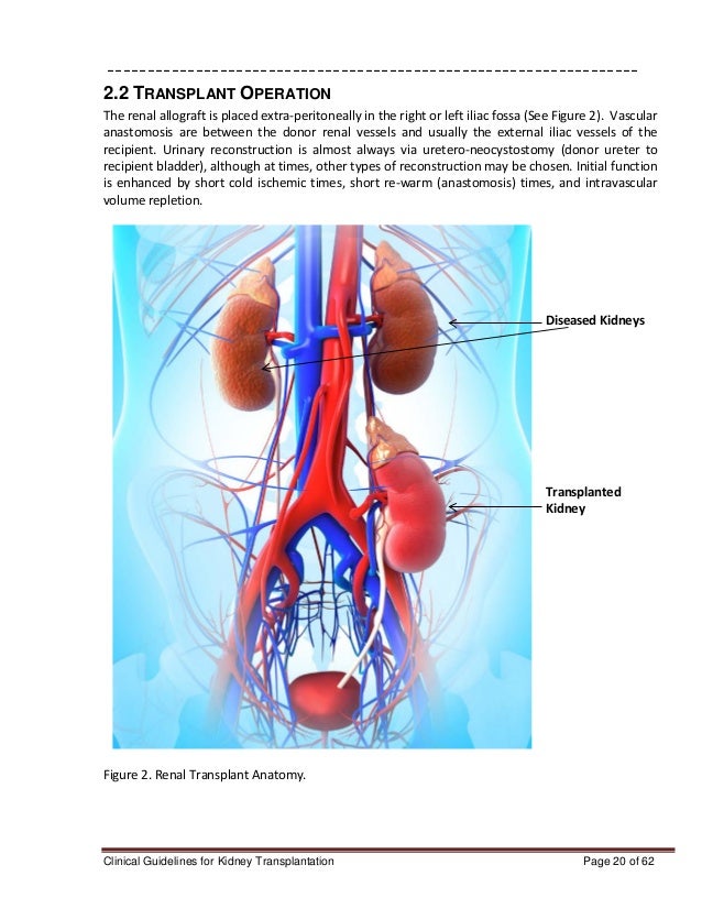 Clinical Guidelines For Kidney Transplantation 0