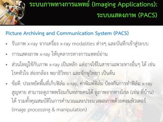 ระบบภาพทางการแพทย์ (Imaging Applications):
ระบบแสดงภาพ (PACS)
Picture Archiving and Communication System (PACS)
• รับภาพ x-ray จากเครื่อง x-ray modalities ต่างๆ และบันทึกเข้าสู่ระบบ
• การแสดงภาพ x-ray ให้บุคลากรทางการแพทย์อ่าน
• ส่วนใหญ่ใช้กับภาพ x-ray เป็นหลัก แต่อาจใช้ในสาขาเฉพาะทางอื่นๆ ได้ เช่น
โรคหัวใจ ส่องกล้อง พยาธิวิทยา และจักษุวิทยา เป็นต้น
• ข้อดี: ประหยัดพื้นที่เก็บฟิล์ม x-ray, ค่าพิมพ์ฟิล์ม ป้องกันการทาฟิล์ม x-ray
สูญหาย สามารถดูภาพพร้อมกันหลายคนได้ ดูภาพจากทางไกล (เช่น ที่บ้าน)
ได้ รวมทั้งคุณสมบัติในการคานวณและประมวลผลภาพด้วยคอมพิวเตอร์
(image processing & manipulation)
 