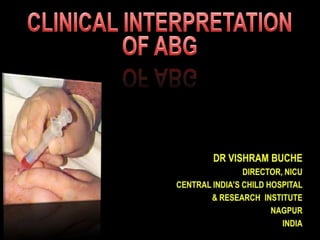CLINICAL INTERPRETATION OF ABG Dr VishramBuche Director, NICU Central InDIA’S CHILD hOSPITAL & Research  INSTITUTE NAGPUR  INDIA 