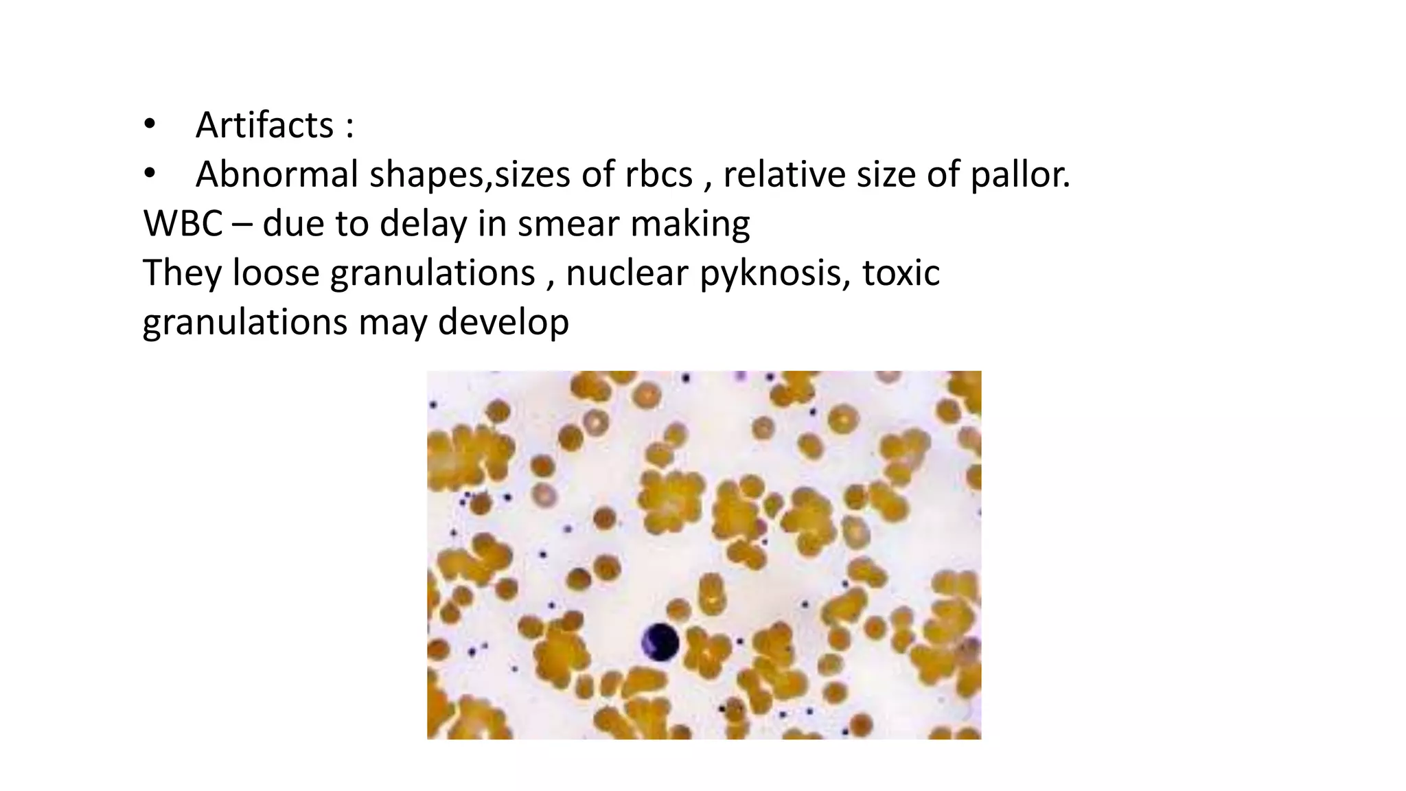 Cd R Cbc Clinical interpretation of cbc | PPTX