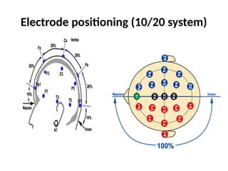 clinical interpretation of eeg and disease based interpretation .pptx