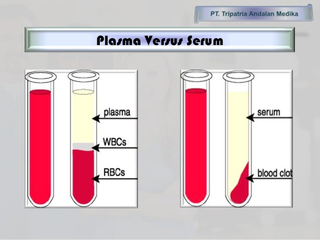 plasma vs serum