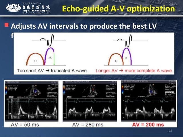 totalcardiagnostics vcds download totalcardiagnostics vcds download