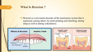 What Is Bruxism ?
 Bruxism is a movement disorder of the masticatory system that is
expressed, among others, by tooth grinding and clenching, during
sleep as well as during wakefulness.
10
 