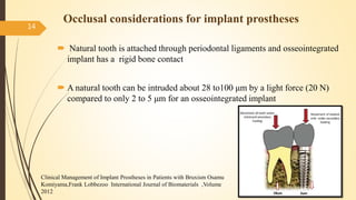 Occlusal considerations for implant prostheses
 Natural tooth is attached through periodontal ligaments and osseointegrated
implant has a rigid bone contact
 A natural tooth can be intruded about 28 to100 μm by a light force (20 N)
compared to only 2 to 5 μm for an osseointegrated implant
14
Clinical Management of Implant Prostheses in Patients with Bruxism Osamu
Komiyama,Frank Lobbezoo International Journal of Biomaterials ,Volume
2012
 