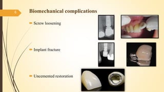Biomechanical complications
 Screw loosening
 Implant fracture
 Uncemented restoration
6
 