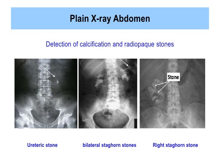 Clinical manifestations of_renal_diseasesffff copy (2)
