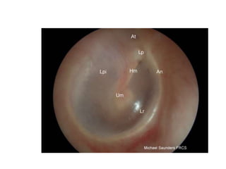 Clinical methods - ENT.pptx