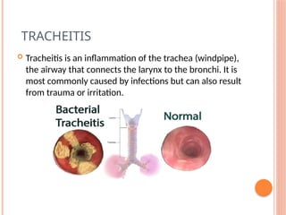 Traechitis Lower respiratory tract infections Clinical microbiology .pptx