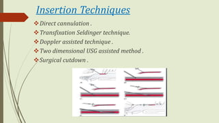 Transfixation Incision Clinical Monitoring by Subhasis Goswami | PPTX