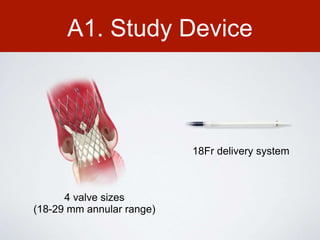 A1. Study Device
4 valve sizes
(18-29 mm annular range)
18Fr delivery system
 