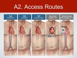 A2. Access Routes
 