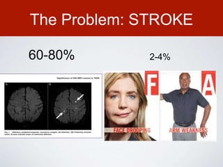 The Problem: STROKE
60-80% 2-4%
 