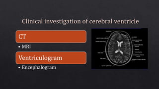 CT
• MRI
Ventriculogram
• Encephalogram
 