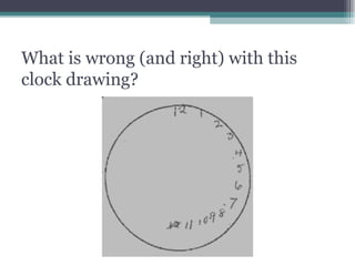 What is wrong (and right) with this clock drawing? 