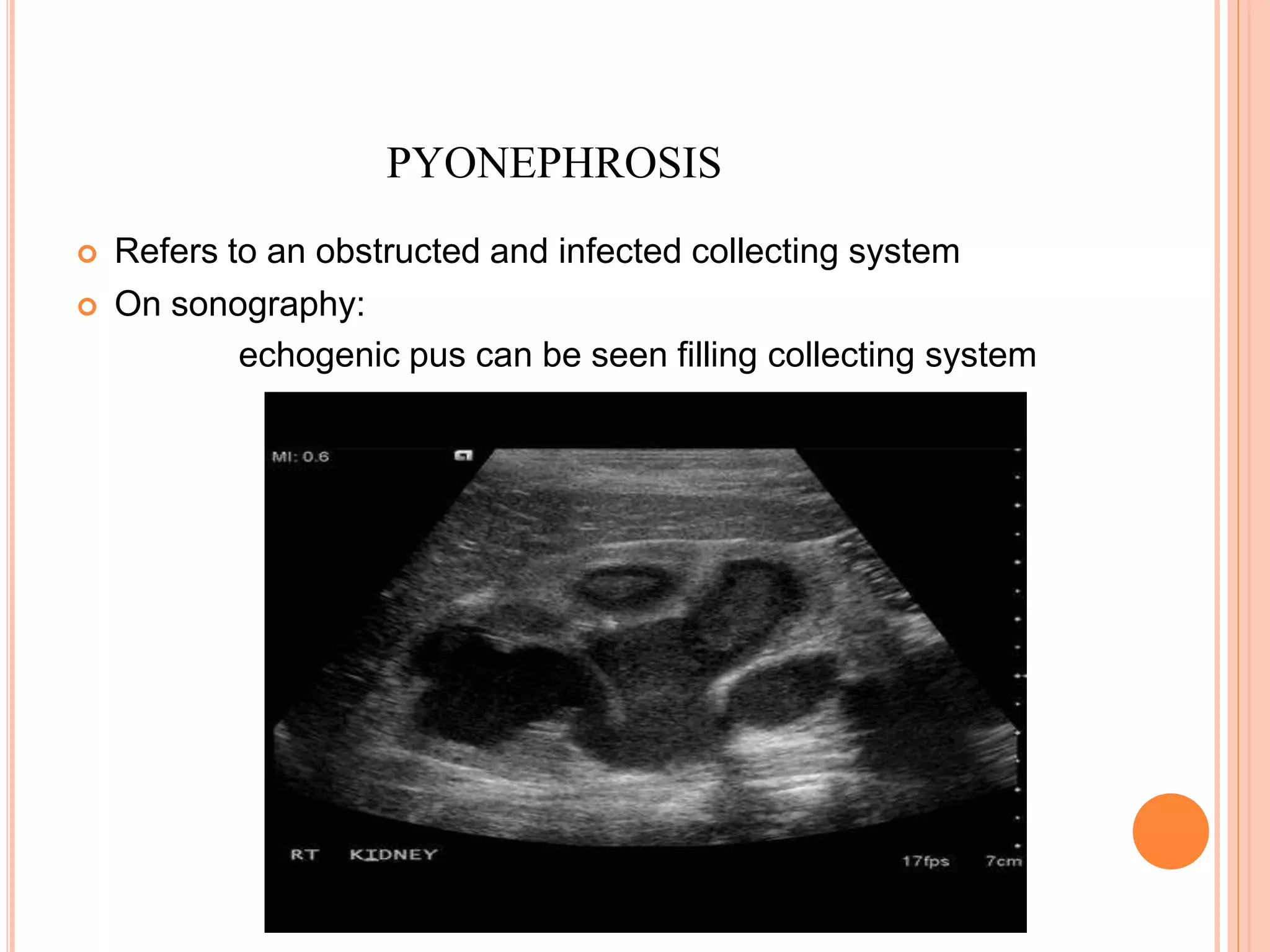 anatomy and sonography of kidney | PPTX