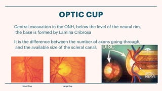 Comprehensive Clinical Evaluation of Optic Nerve Head in Glaucoma ...