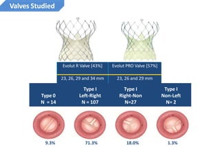 Evolut R Sizes Clinical papers on TAVR | PPTX