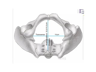 INTRODUCTION TO CLINICAL PELVIMETRY.pptx