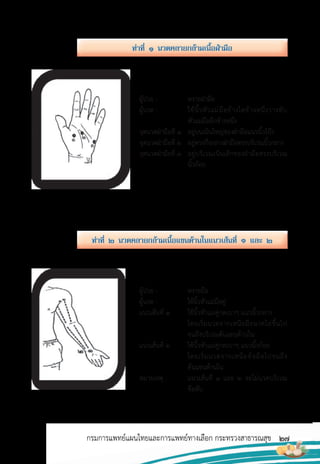27
กรมการแพทย์แผนไทยและการแพทย์ทางเลือก กระทรวงสาธารณสุข
ท่ำที่ ๒ นวดคลำยกล้ำมเนื้อแขนด้ำนในแนวเส้นที่ ๑ และ ๒
ท่ำที่ ๑ นวดคลำยกล้ำมเนื้อฝ่ำมือ
ผู้ป่วย : หงายฝ่ามือ
ผู้นวด : ใช้นิ้วหัวแม่มือข้างใดข้างหนึ่งวางทับ
หัวแม่มืออีกข้างหนึ่ง
จุดนวดฝ่ามือที่ 1 อยู่บนเนินใหญ่ของฝ่ามือแนวนิ้วโป้ง
จุดนวดฝ่ามือที่ 2 อยู่ตรงกึ่งกลางฝ่ามือตรงบริเวณนิ้วกลาง
จุดนวดฝ่ามือที่ 3 อยู่บริเวณเนินเล็กของฝ่ามือตรงบริเวณ
นิ้วก้อย
ผู้ป่วย : หงายมือ
ผู้นวด : ใช้นิ้วหัวแม่มือคู่
แนวเส้นที่ 1 ใช้นิ้วหัวแม่คู่กดเบาๆ แนวนิ้วกลาง
โดยเริ่มนวดจากเหนือมือนวดไล่ขึ้นไป
จนถึงบริเวณต้นแขนด้านใน
แนวเส้นที่ 2 ใช้นิ้วหัวแม่คู่กดเบาๆ แนวนิ้วก้อย
โดยเริ่มนวดจากเหนือข้อมือไปจนถึง
ต้นแขนด้านใน
หมายเหตุ : แนวเส้นที่ 1 และ 2 จะไม่นวดบริเวณ
ข้อพับ
 