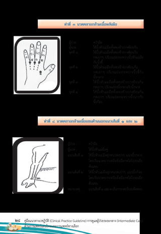 28 คู่มือแนวทางเวชฏิบัติ (Clinical Practice Guideline) การดูแลผู้ป่วยระยะกลาง (Intermediate Care)
ด้านการแพทย์แผนไทยและการแพทย์ทางเลือก
ท่ำที่ ๓ นวดคลำยกล้ำมเนื้อหลังมือ
ท่ำที่ ๔ นวดคลำยกล้ำมเนื้อแขนด้ำนนอกแนวเส้นที่ ๑ และ ๒
ผู้ป่วย : คว�่ามือ
ผู้นวด : ใช้นิ้วหัวแม่มือคู่
แนวเส้นที่ 1 ใช้นิ้วหัวแม่มือคู่กดนวดเบาๆ แนวนิ้วกลาง
โดยเริ่มนวดจากเหนือข้อมือกดไล่ไปจนถึง
ต้นแขน
แนวเส้นที่ 2 ใช้นิ้วหัวแม่มือคู่กดนวดเบาๆ แนวนิ้วก้อย
โดยเริ่มนวดจากเหนือข้อมือกดไล่ไปจนถึง
ต้นแขน
หมายเหตุ : แนวเส้นที่1และ2เว้นการกดบริเวณข้อศอก
ผู้ป่วย : คว�่ามือ
ผู้นวด : ใช้นิ้วหัวแม่มือทั้งสองข้างวางซ้อนกัน
จุดที่ 1 ใช้นิ้วหัวแม่มือทั้งสองข้างวางซ้อนกัน
กดเบาๆ บริเวณร่องระหว่างนิ้วหัวแม่มือ
กับนิ้วชี้
จุดที่ 2 ใช้นิ้วหัวแม่มือทั้งสองข้างวางซ้อนกัน
กดเบาๆ บริเวณร่องระหว่างนิ้วชี้กับ
นิ้วกลาง
จุดที่ 3 ใช้นิ้วหัวแม่มือทั้งสองข้างวางซ้อนกัน
กดเบาๆ บริเวณร่องนิ้วกลางกับนิ้วนาง
จุดที่ 4 ใช้นิ้วหัวแม่มือทั้งสองข้างวางซ้อนกัน
กดเบาๆ บริเวณร่องระหว่างนิ้วนางกับ
นิ้วก้อย
 