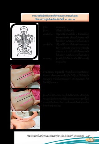 35
กรมการแพทย์แผนไทยและการแพทย์ทางเลือก กระทรวงสาธารณสุข
ผู้ป่วย : นอนตะแคง
ผู้นวด : ใช้นิ้วหัวแม่มือทั้ง 2 ข้าง
แนวเส้นที่ 1 ให้ผู้นวดใช้นิ้วหัวแม่มือทั้ง 2 ข้างกดลงเบาๆ
ชิดกระดูกสันหลัง แล้ววนเป็นก้นหอย กดไล่
ขึ้นไปเรื่อยๆจนถึงต้นคอ(นวดขึ้นอย่างเดียว)
แนวเส้นที่ 2 ให้ผู้นวดใช้นิ้วหัวแม่มือทั้ง 2 ข้างกดลงเบา ๆ
ชิดกระดูกสันหลัง ห่างจากกระดูกสันหลัง
ประมาณ 1 นิ้ว แล้ววนเป็นก้นหอย กดไล่
ขึ้นไปเรื่อยๆจนถึงต้นคอ(นวดขึ้นอย่างเดียว)
หมายเหตุ : ผู้นวดบีบน�้ามันใส่ฝ่ามือ ชโลมให้ทั่วแผ่นหลัง
(ท่าลูบเอาใจ)
ภาพประกอบ ท่าลูบเอาใจ (ท�าหลังสิ้นสุดการนวดสัมผัสทุก
ขั้นตอน) เพื่อผ่อนคลายกล้ามเนื้อ ให้ผู้ป่วยรู้สึกถึงสัมผัส
ที่ผ่อนคลาย ท่านี้จะให้ผู้ป่วยนอนคว�่า หรือ นอนตะแคง ก็ได้
ในท่าที่ผู้ป่วยสะดวก
ผู้นวดบีบน�้ามันใส่ฝ่ามือ ชโลมน�้ามันให้ทั่วฝ่ามือ แล้วใช้อุ้งมือ
ขวาและอุ้งมือซ้ายวางบนหลังผู้ป่วยออกแรงกดเบาๆลูบขึ้นไป
จากเอวไปถึงบริเวณบ่าไหล่ จากนั้นหมุนฝ่ามือแล้วลูบลงด้าน
ข้างล�าตัวลงมาจนถึงเอว
กำรนวดสัมผัสบริเวณหลังท่ำนอนตะแคงวนก้นหอย
ชิดแนวกระดูกสันหลังแล้วเส้นที่ ๑ และ ๒
 