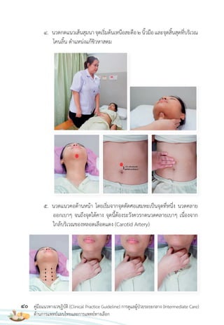 40 คู่มือแนวทางเวชฏิบัติ (Clinical Practice Guideline) การดูแลผู้ป่วยระยะกลาง (Intermediate Care)
ด้านการแพทย์แผนไทยและการแพทย์ทางเลือก
4. นวดกดแนวเส้นสุมนาจุดเริ่มต้นเหนือสะดือ2นิ้วมือและจุดสิ้นสุดที่บริเวณ
โคนลิ้น ต�าแหน่งแก้ชิวหาสดม
5. นวดแนวคอด้านหน้า โดยเริ่มจากจุดตัดศอเสมหะเป็นจุดที่หนึ่ง นวดคลาย
ออกเบาๆ จนถึงจุดใต้คาง จุดนี้ต้องระวังควรกดนวดคลายเบาๆ เนื่องจาก
ใกล้บริเวณของหลอดเลือดแดง (Carotid Artery)
 
