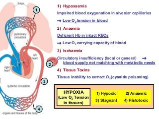 1
4
3
2
1) Hypoxaemia
Impaired blood oxygenation in alveolar capillaries
→ Low O2 tension in blood
2) Anaemia
Deficient Hb in intact RBCs
→ Low O2 carrying capacity of blood
3) Ischaemia
Circulatory insufficiency (local or general) →
blood supply not matching with metabolic needs
4) Tissue Toxins
Tissue inability to extract O2 (cyanide poisoning)
1) Hypoxic 2) Anaemic
3) Stagnant 4) Histotoxic
HYPOXIA
(Low O2 Tension
in tissues)
 