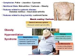 Muscle wasting / CachexiaMuscle wasting / Cachexia
Obesity
Hypoventilation
Syndrome
• Complexion: Pallor – Jaundice - Cyanosis
• Nutritional State: Malnutrition / Cachexia – Obesity
• Features related to systemic disease:
Diabetes mellitus – rheumatoid arthritis
• Features related to drug toxicity: cushinoid facies
 