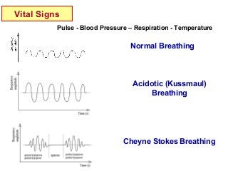 Vital Signs
Pulse - Blood Pressure – Respiration - Temperature
Normal Breathing
Cheyne Stokes Breathing
Acidotic (Kussmaul)
Breathing
 