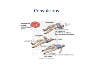 Clinical presentation of neurological diseases in children 2021 | PDF