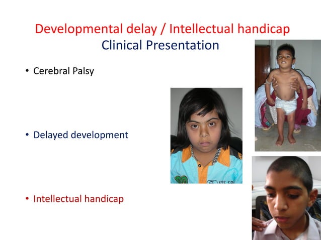 Clinical presentation of neurological diseases in children 2021 | PDF