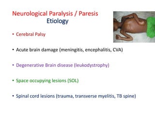 Clinical presentation of neurological diseases in children 2021 | PDF