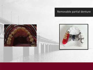 Dental clinical case presentation | PPTX