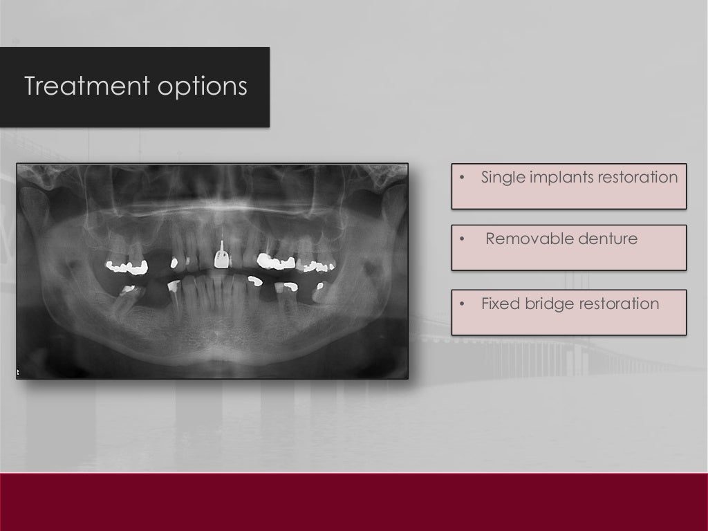 dental-clinical-case-presentation
